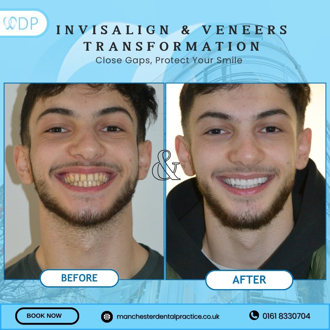 Smile Gallery 1