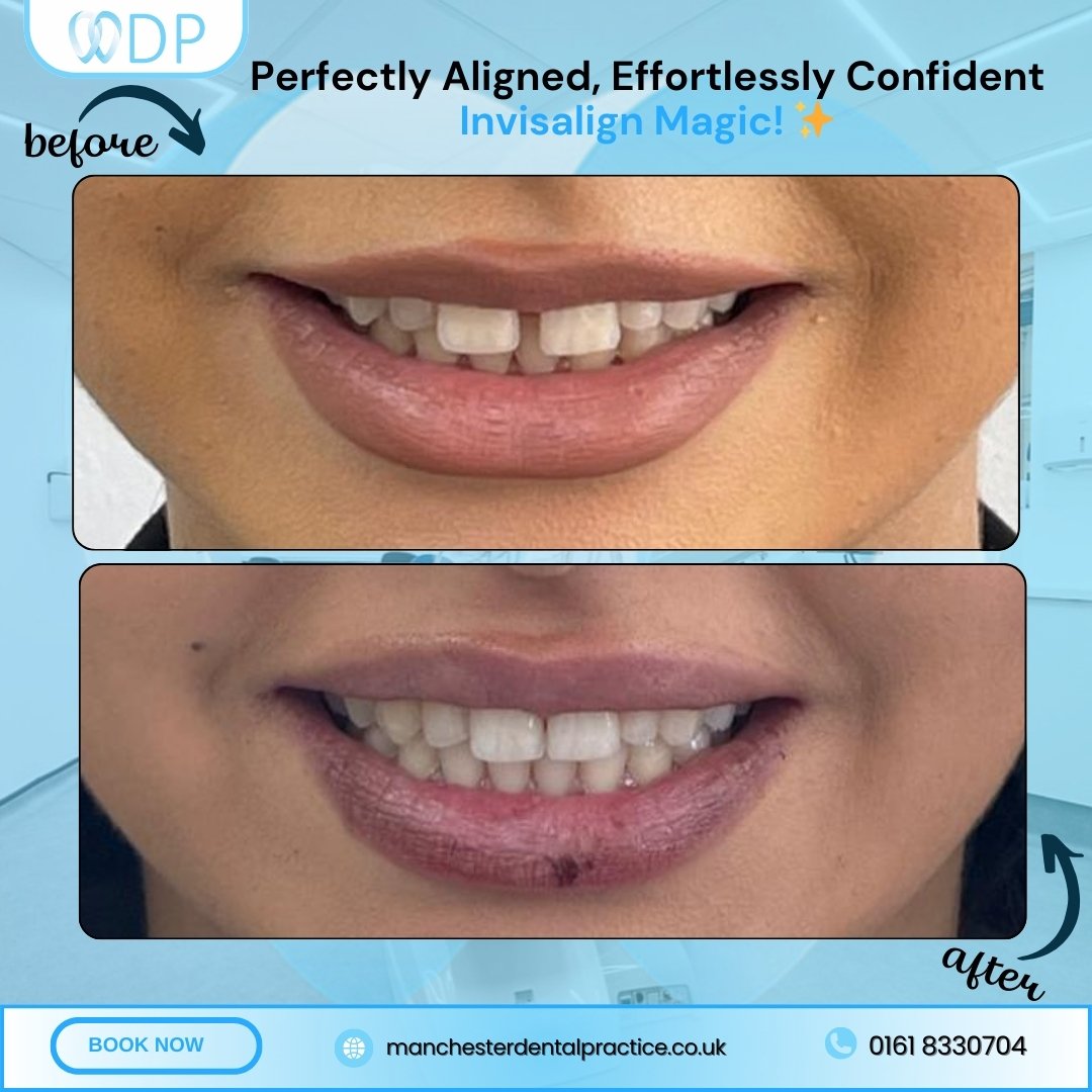 Smile Gallery 6