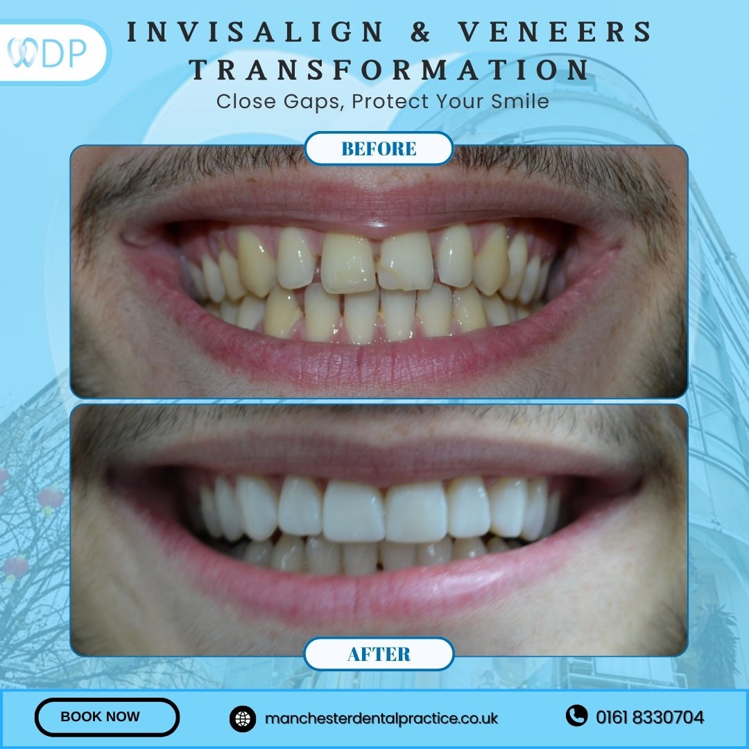 Smile Gallery 5