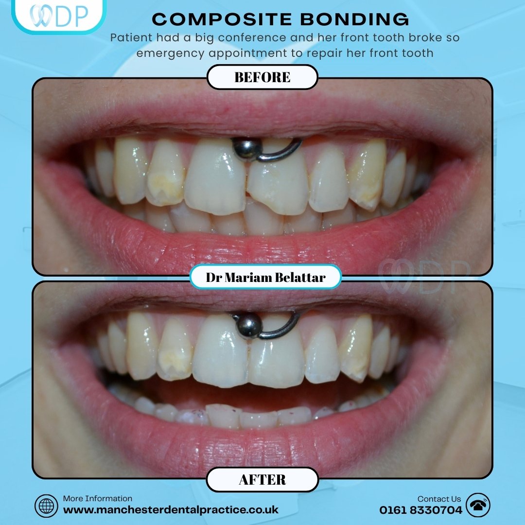 Smile Gallery 6